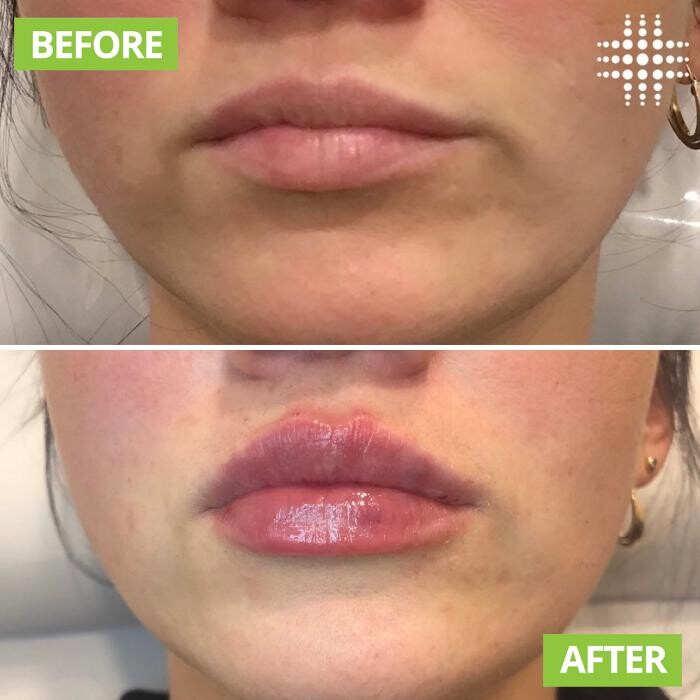 Images Results Laser Clinic Blacktown
