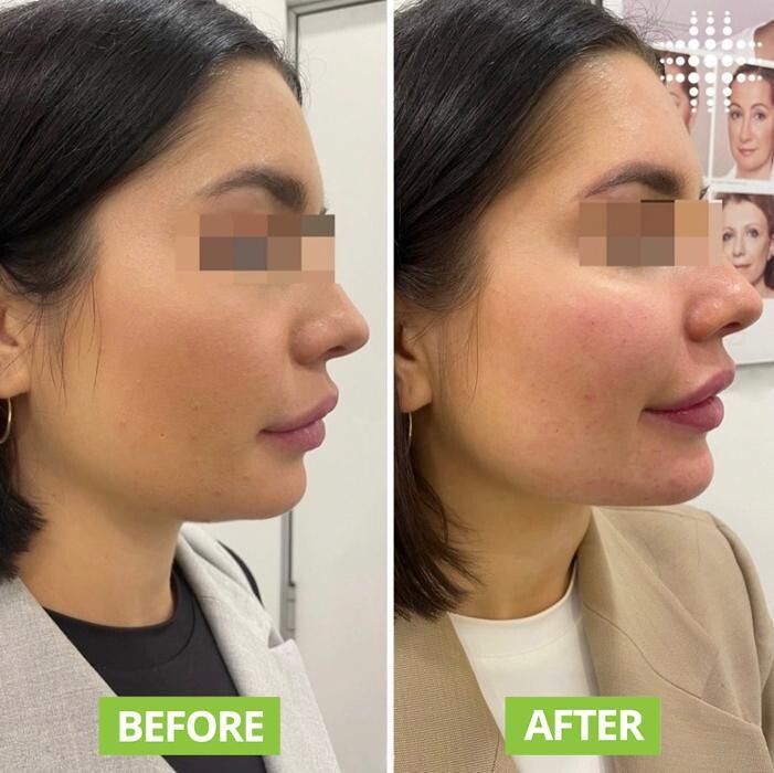Images Results Laser Clinic Blacktown