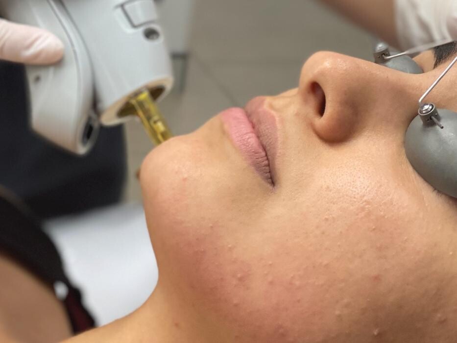 Images Results Laser Clinic Blacktown