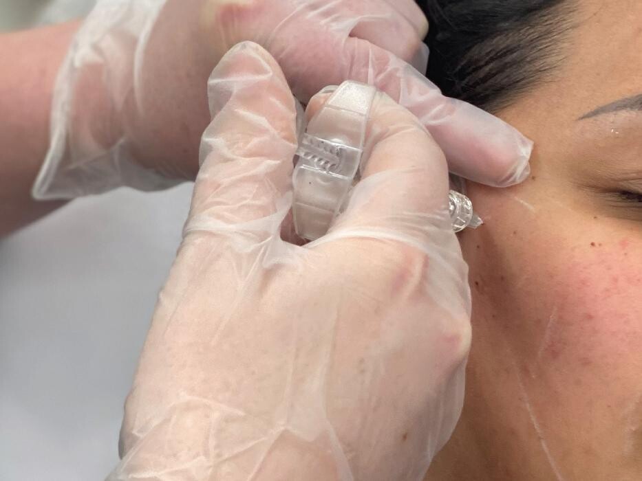 Images Results Laser Clinic Blacktown