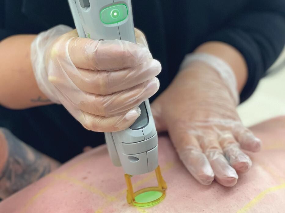 Images Results Laser Clinic Blacktown