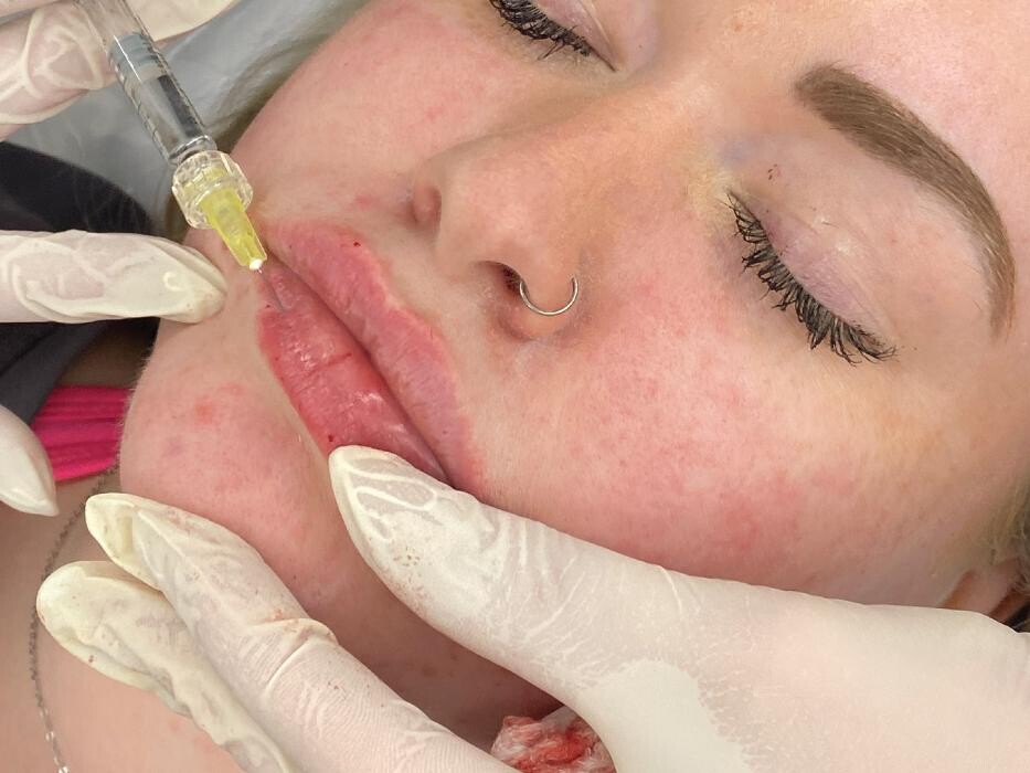 Images Results Laser Clinic Blacktown