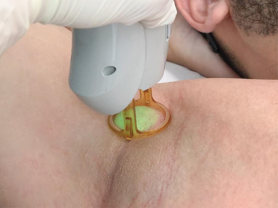 Images Results Laser Clinic Blacktown