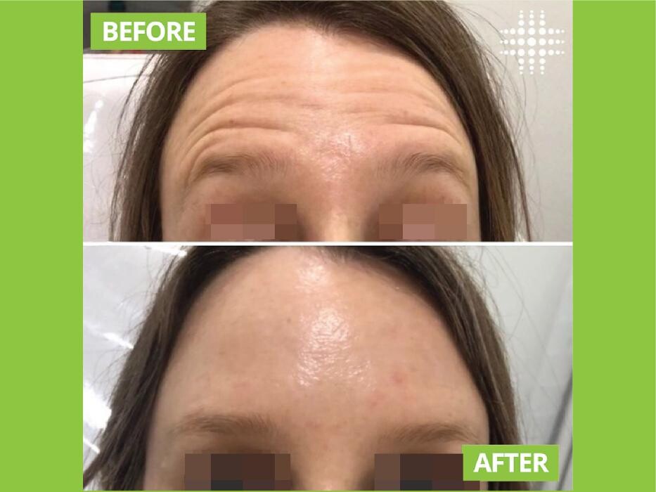 Images Results Laser Clinic Blacktown