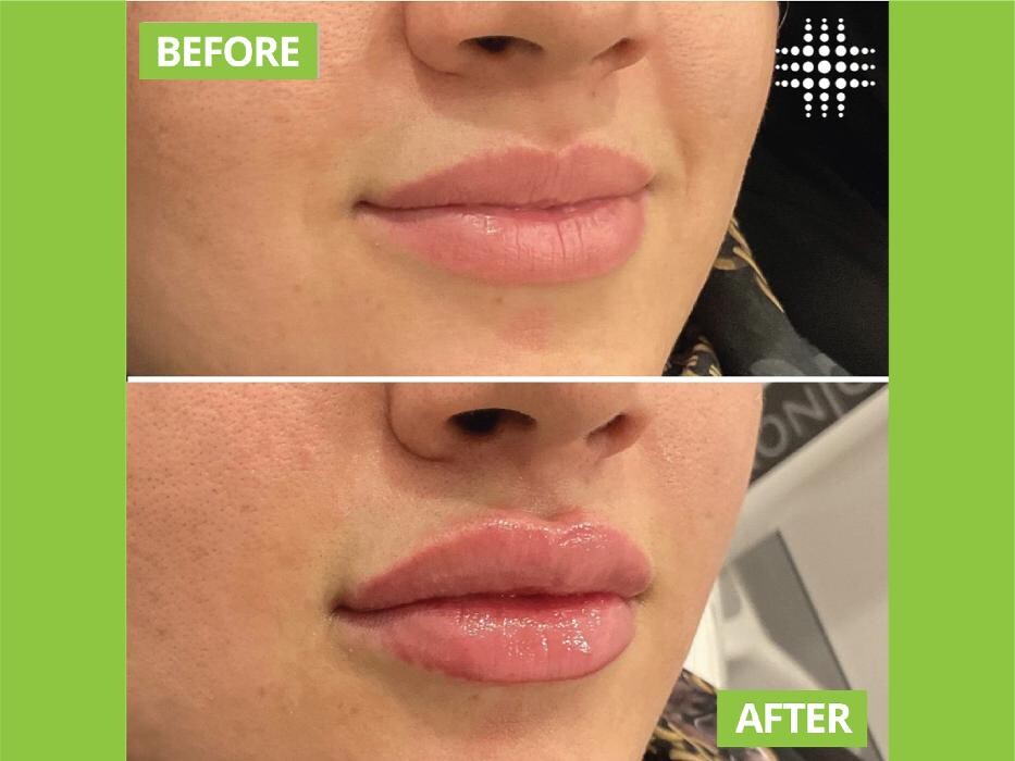 Images Results Laser Clinic Blacktown