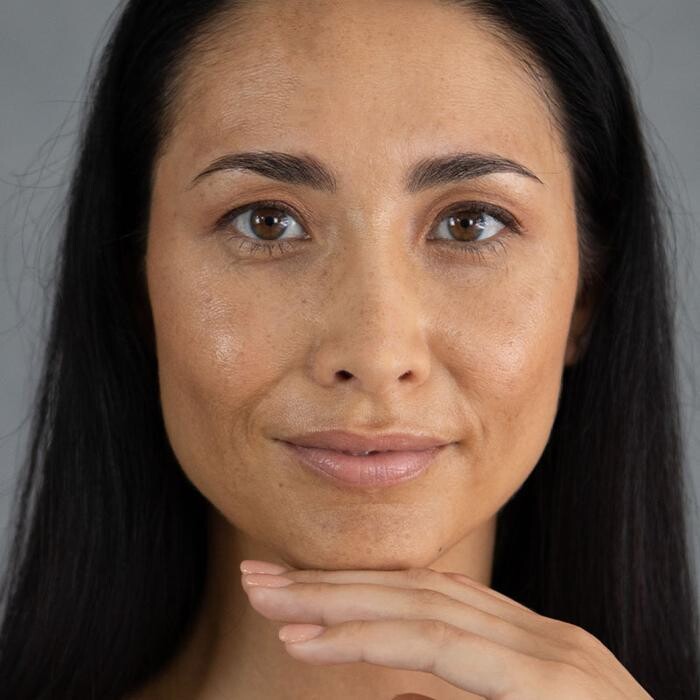 Images Results Laser Clinic Airport West