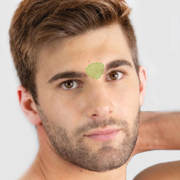 Images Results Laser Clinic Airport West