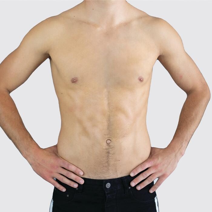 Images Results Laser Clinic Airport West