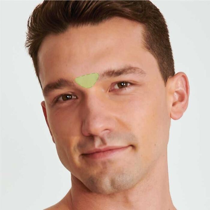 Images Results Laser Clinic Airport West