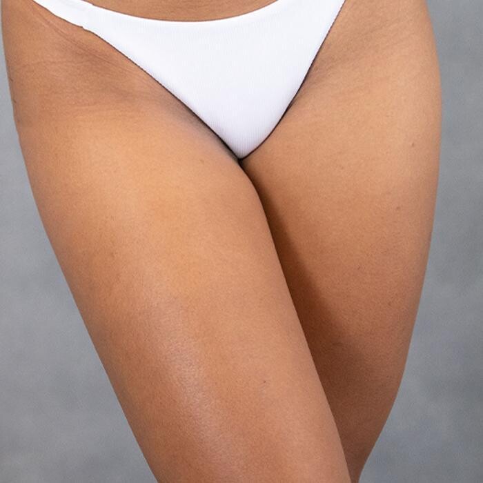 Images Results Laser Clinic Airport West