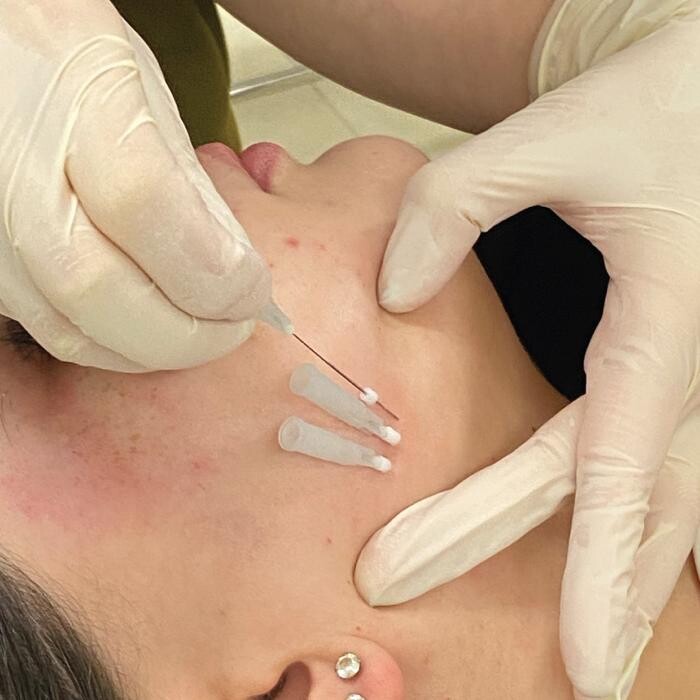 Images Results Laser Clinic Airport West