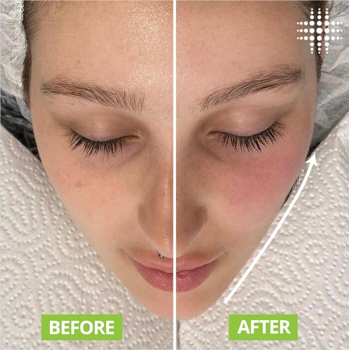 Images Results Laser Clinic Airport West