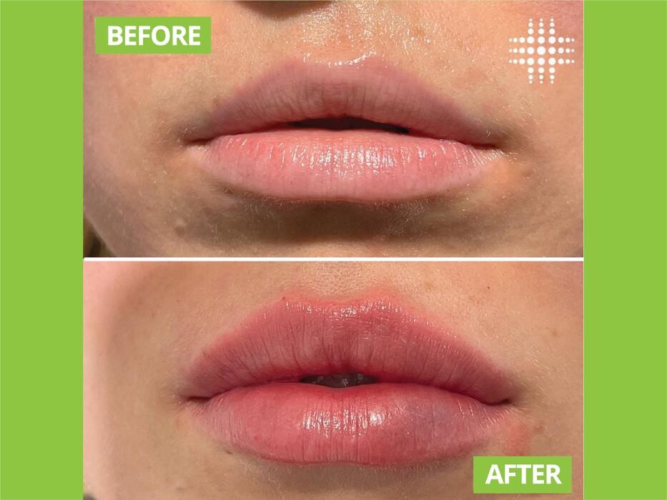 Images Results Laser Clinic Airport West