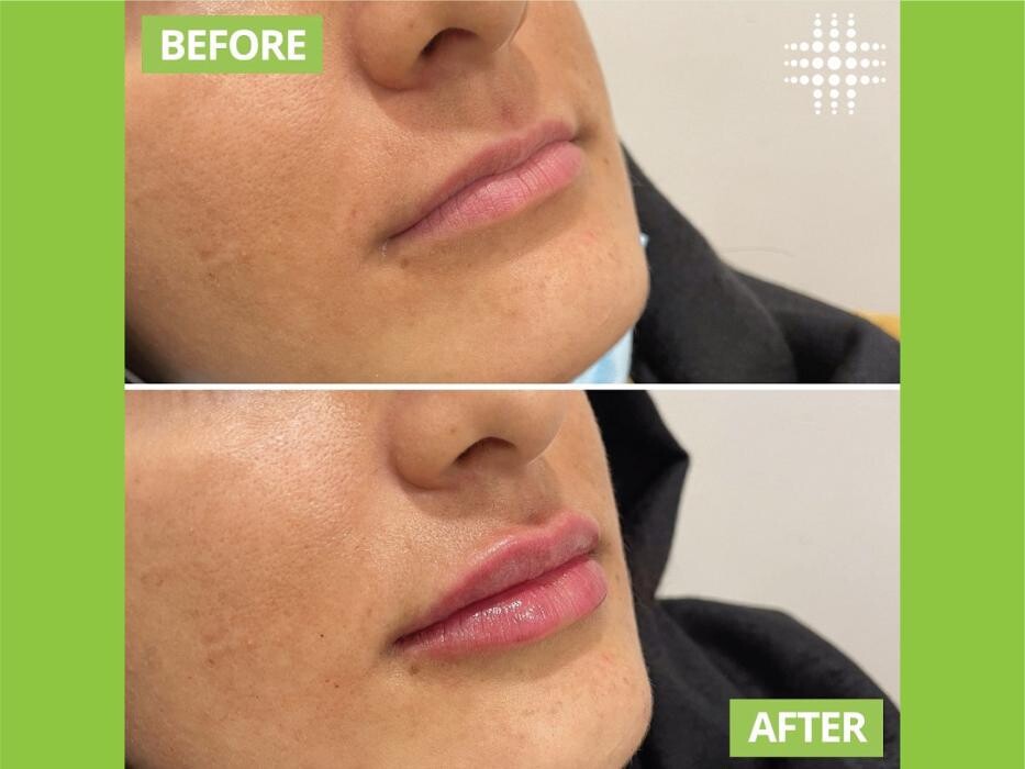 Images Results Laser Clinic Airport West