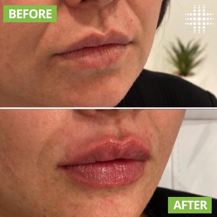 Images Results Laser Clinic Airport West