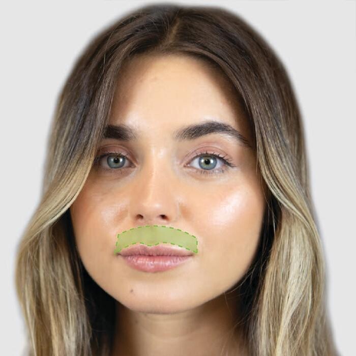 Images Results Laser Clinic Erina