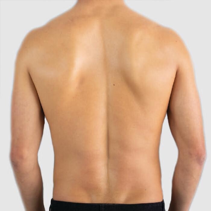 Images Results Laser Clinic Melbourne CBD