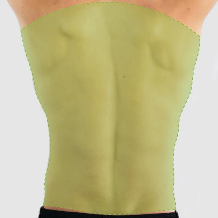 Images Results Laser Clinic Melbourne CBD
