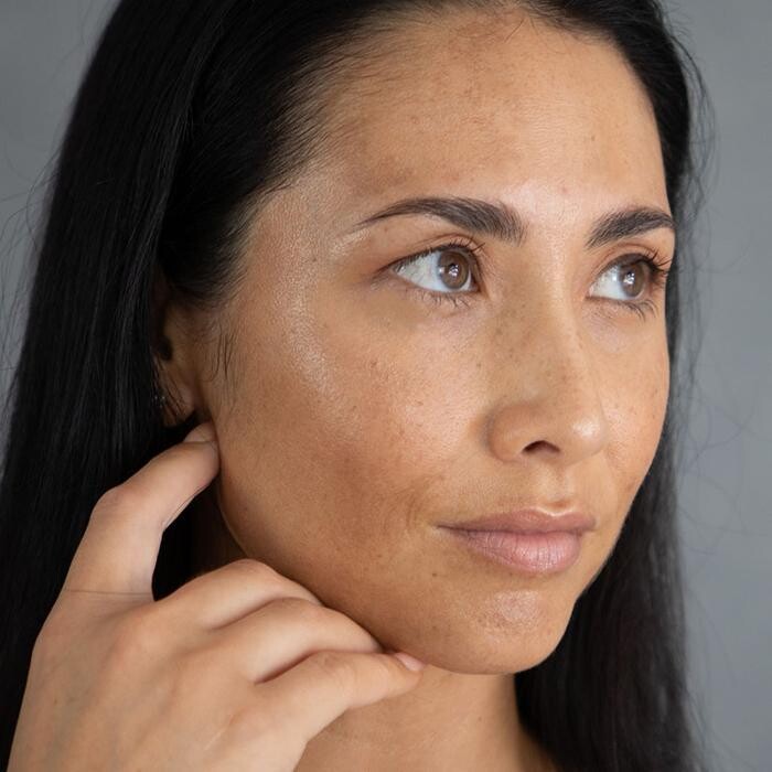 Images Results Laser Clinic Melbourne CBD