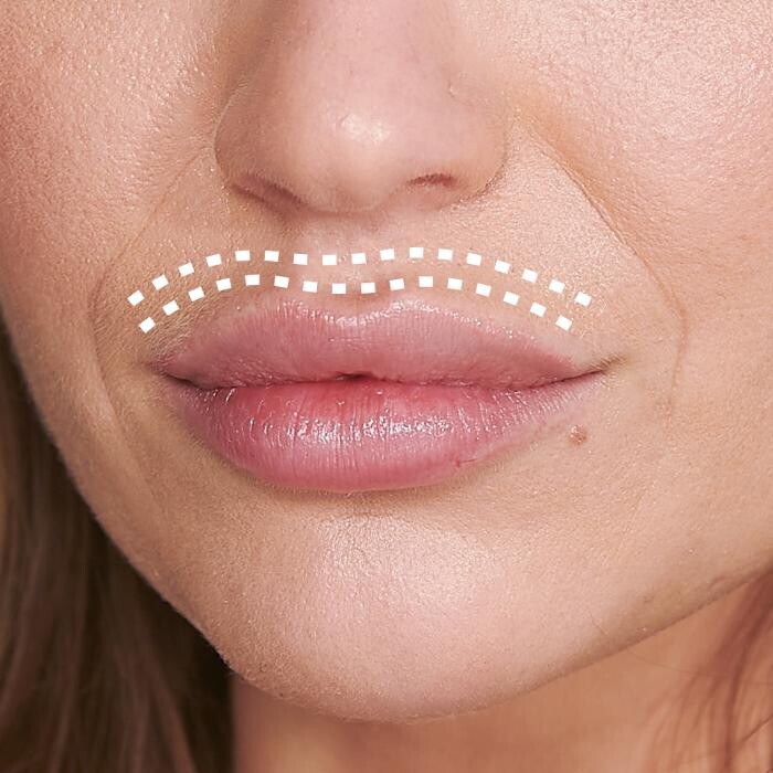Images Results Laser Clinic Melbourne CBD