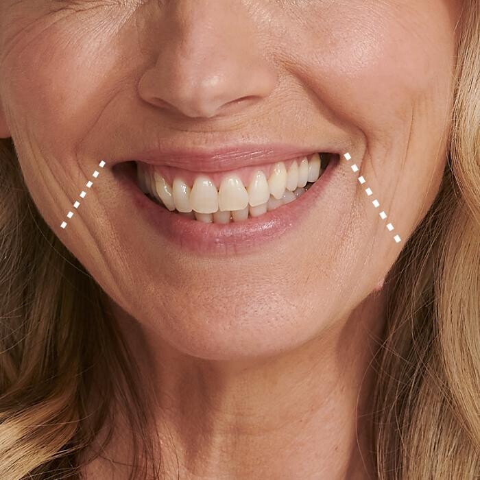Images Results Laser Clinic Melbourne CBD