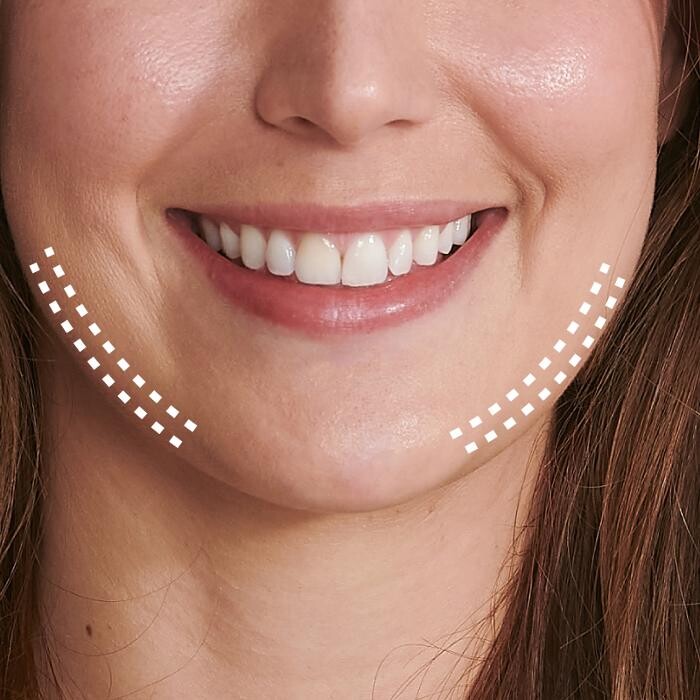 Images Results Laser Clinic Melbourne CBD
