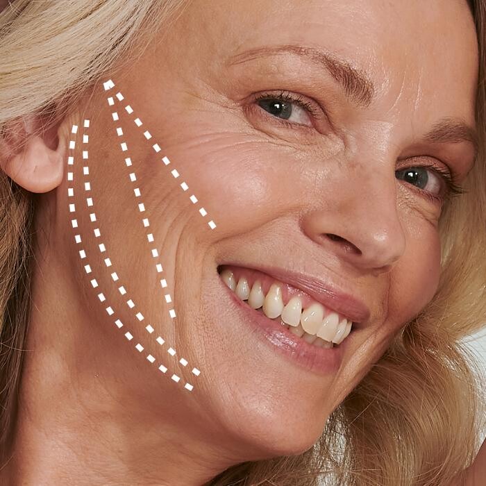 Images Results Laser Clinic Melbourne CBD