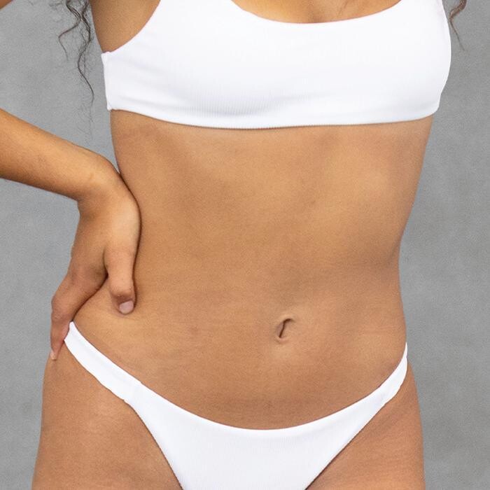 Images Results Laser Clinic Melbourne CBD