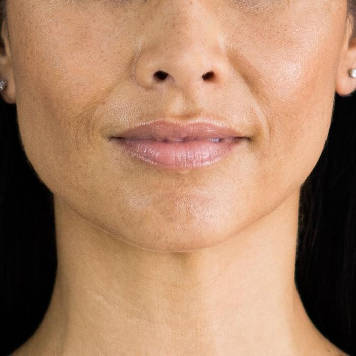 Images Results Laser Clinic Melbourne CBD