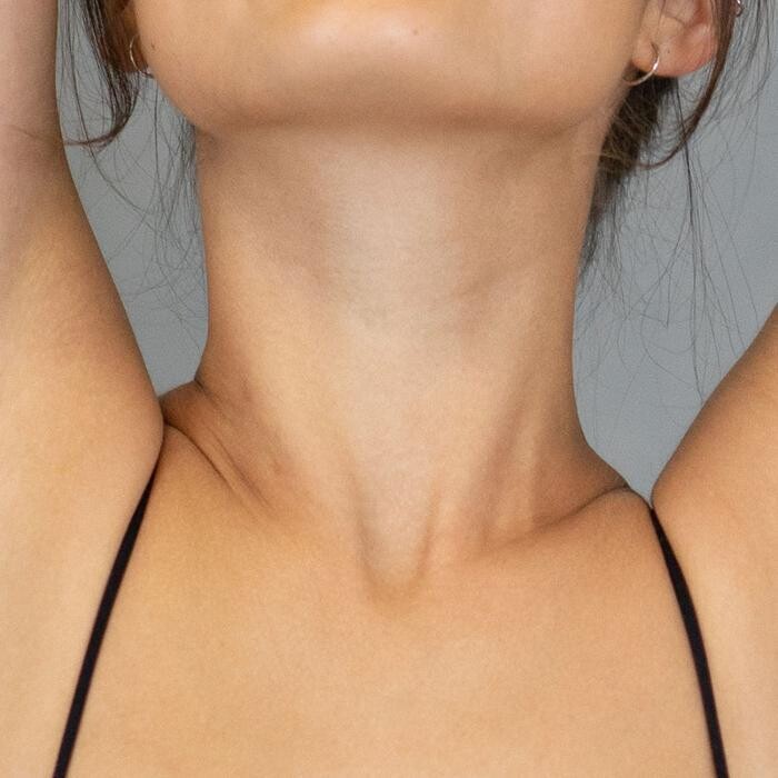 Images Results Laser Clinic Melbourne CBD