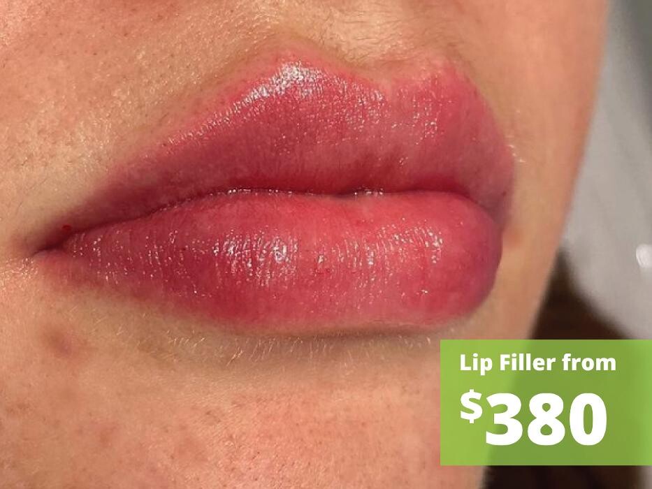 Images Results Laser Clinic Melbourne CBD