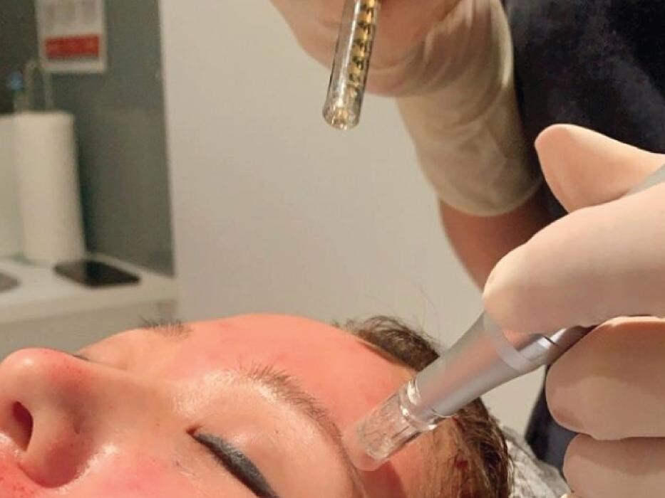 Images Results Laser Clinic Melbourne CBD