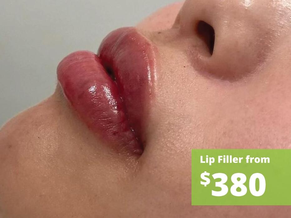 Images Results Laser Clinic Melbourne CBD