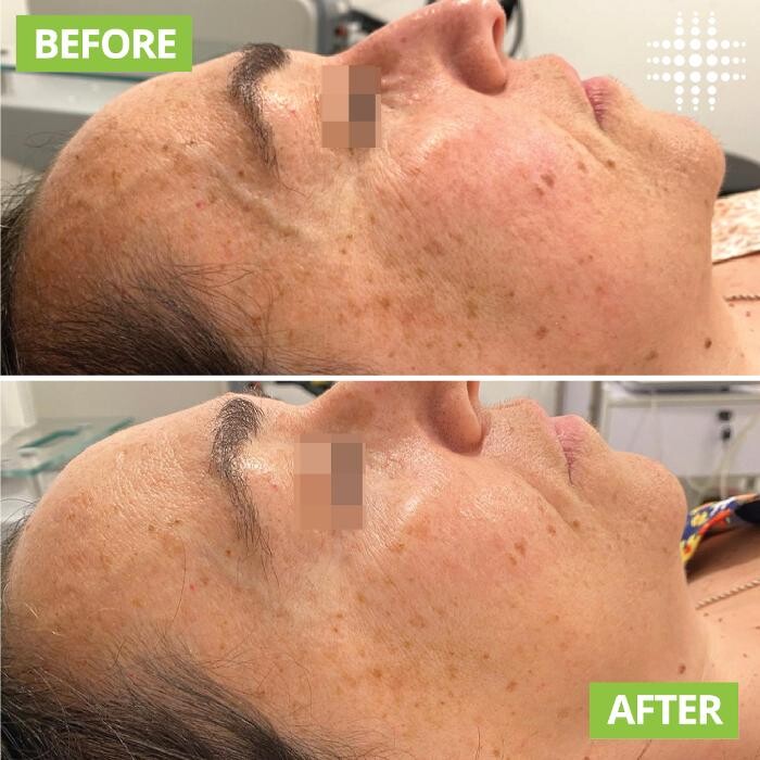 Images Results Laser Clinic Melbourne CBD