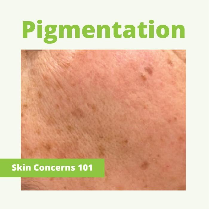 Images Results Laser Clinic Melbourne CBD