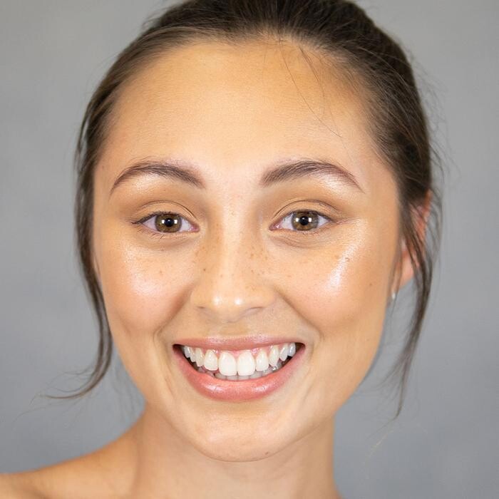Images Results Laser Clinic Melbourne CBD