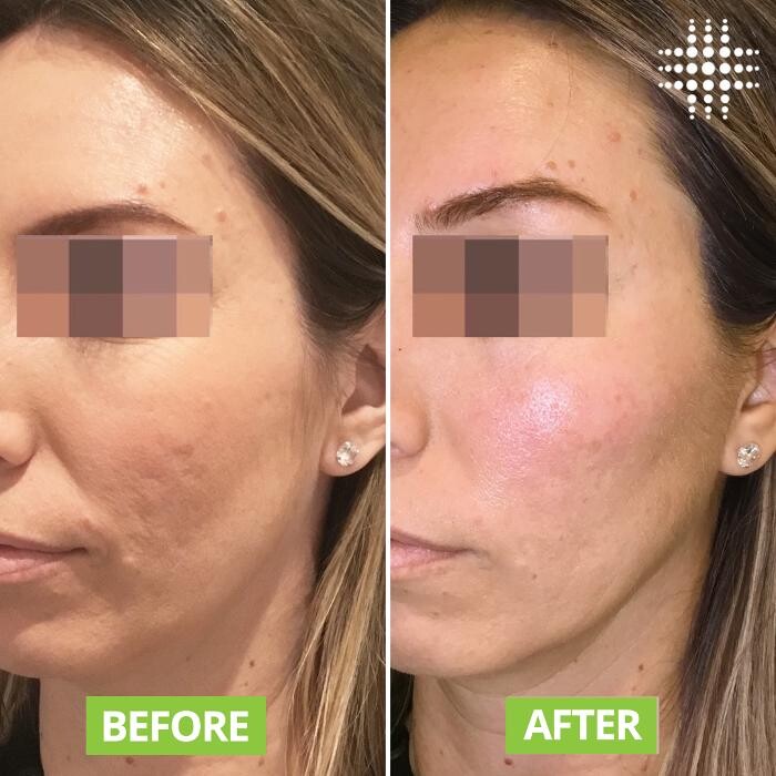 Images Results Laser Clinic Melbourne CBD