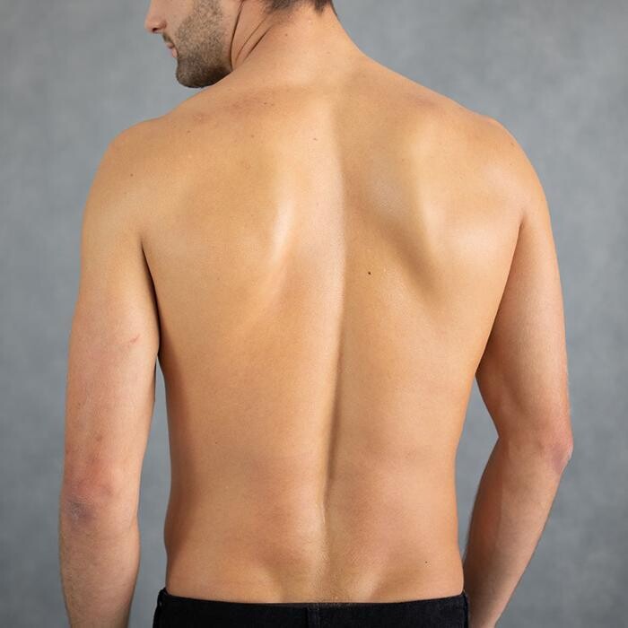 Images Results Laser Clinic Melbourne CBD