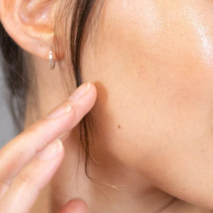 Images Results Laser Clinic Melbourne CBD