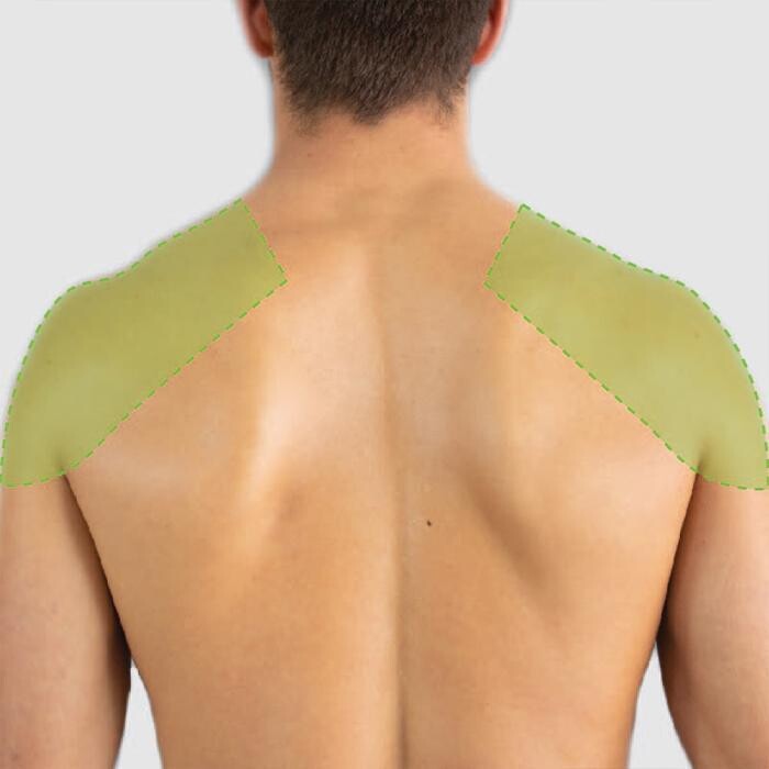 Images Results Laser Clinic Melbourne CBD