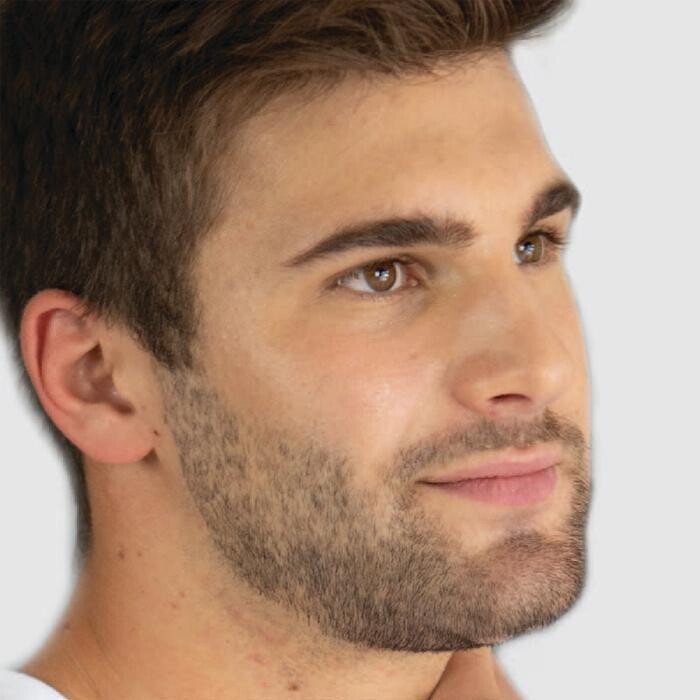 Images Results Laser Clinic Melbourne CBD
