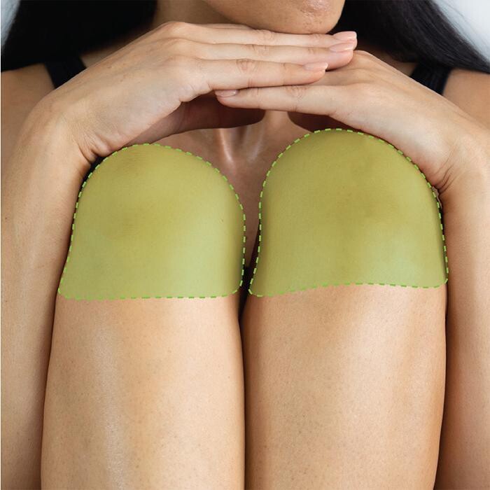 Images Results Laser Clinic Melbourne CBD
