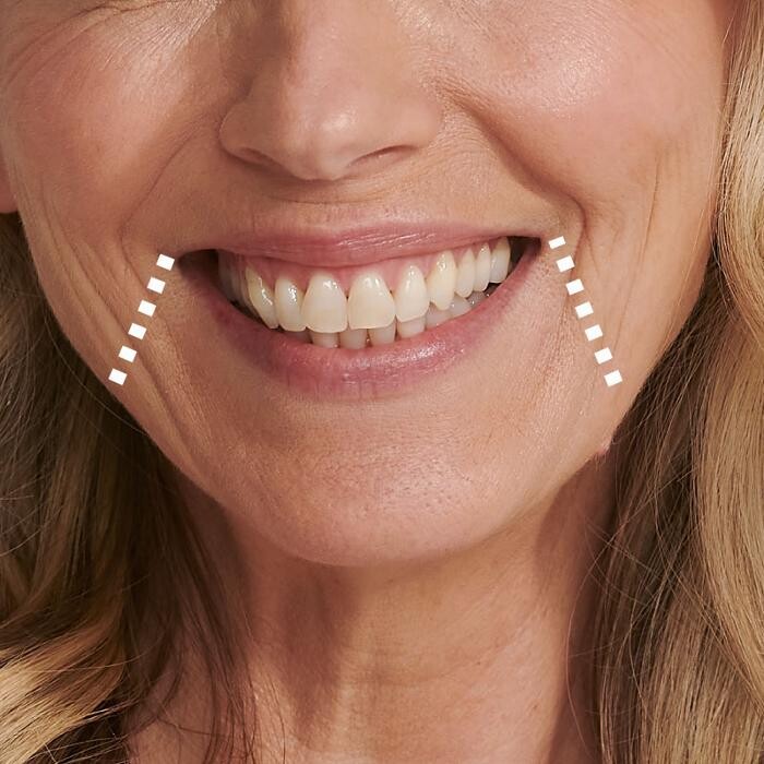 Images Results Laser Clinic Melbourne CBD