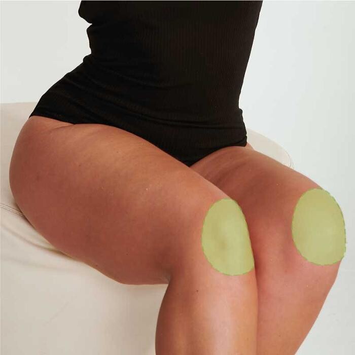 Images Results Laser Clinic Melbourne CBD