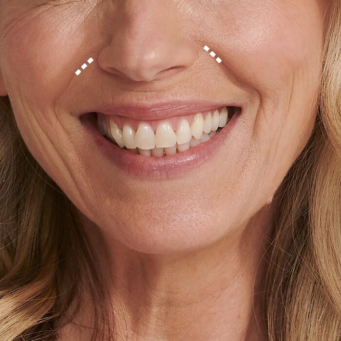 Images Results Laser Clinic Melbourne CBD