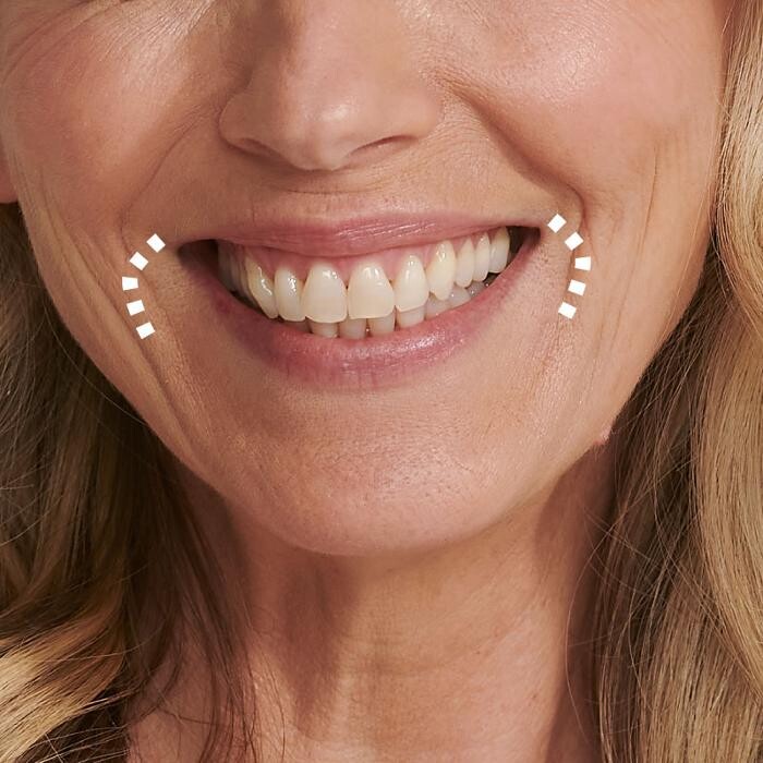 Images Results Laser Clinic Melbourne CBD