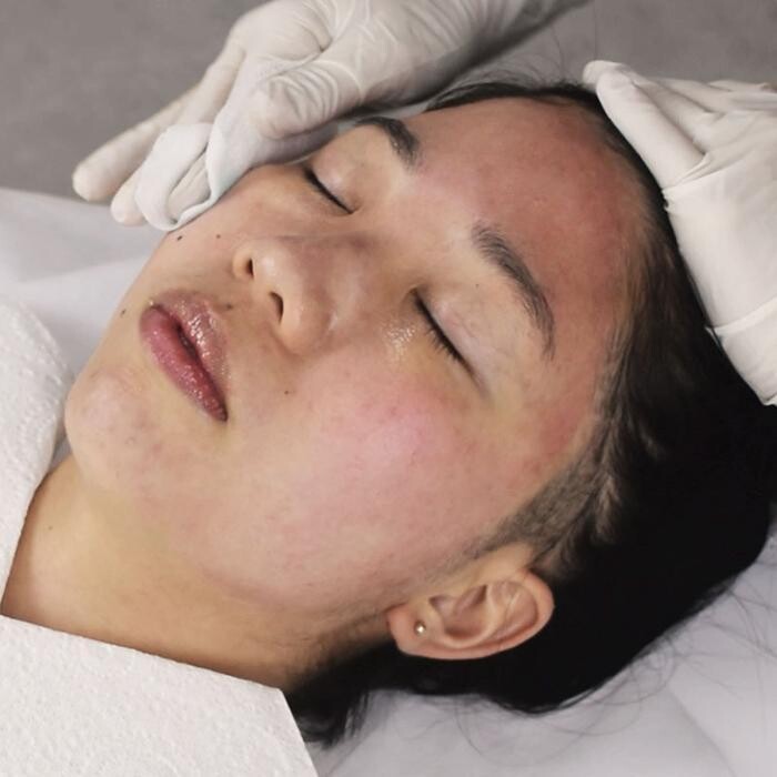 Images Results Laser Clinic Melbourne CBD