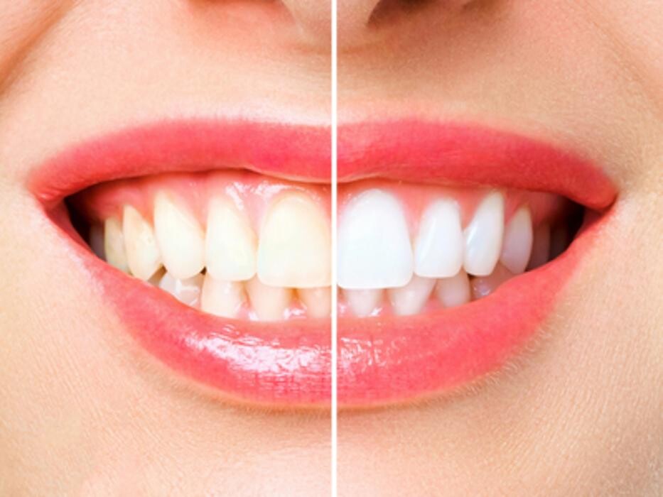 Images Gentle Dental Care Campbelltown