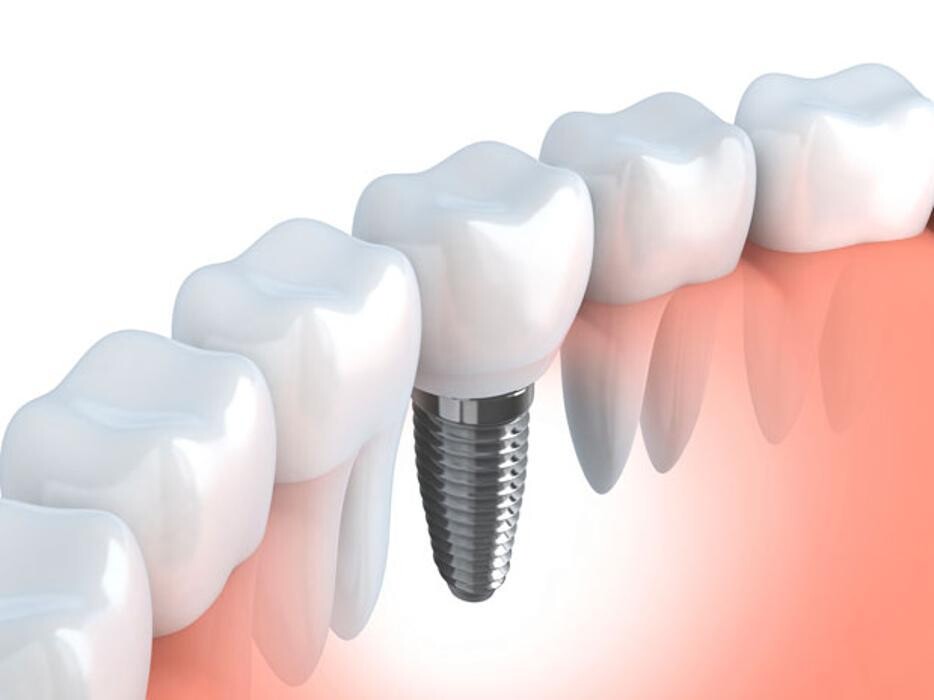 Images Gentle Dental Care Campbelltown