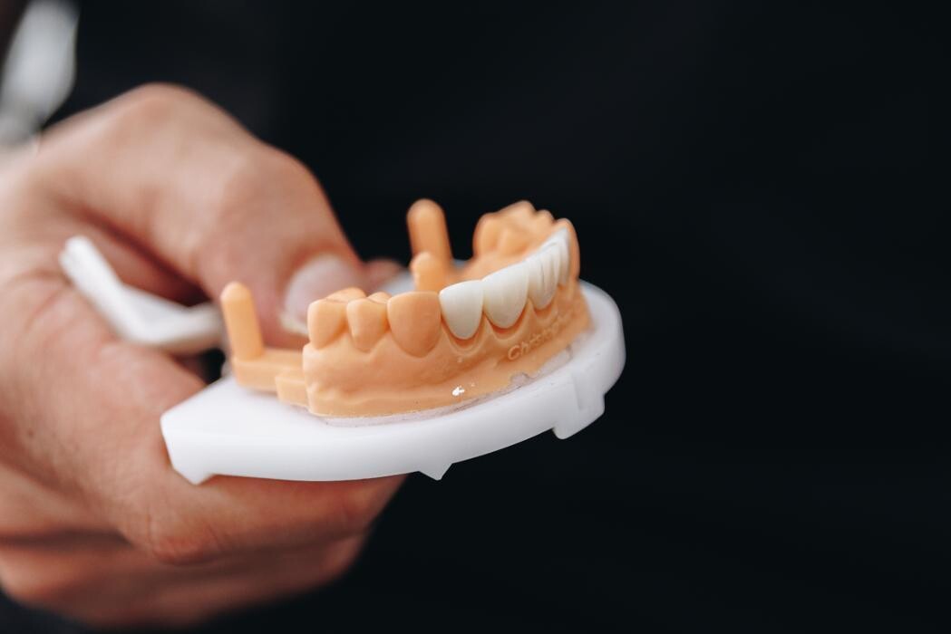 Images Mingara Dental & Implant Centre I Central Coast Dentist